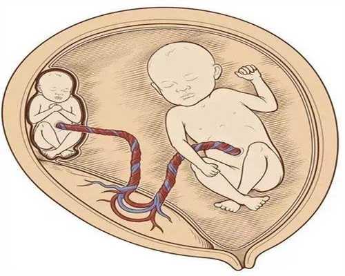 长沙怎么去代怀,长沙哪家医院可做供卵